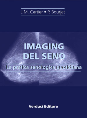 Imaging del Seno