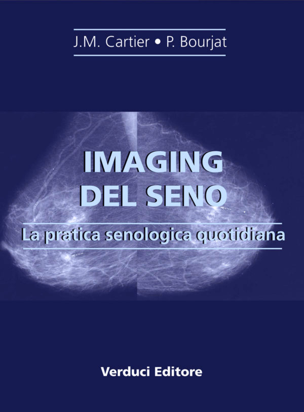 Imaging del Seno