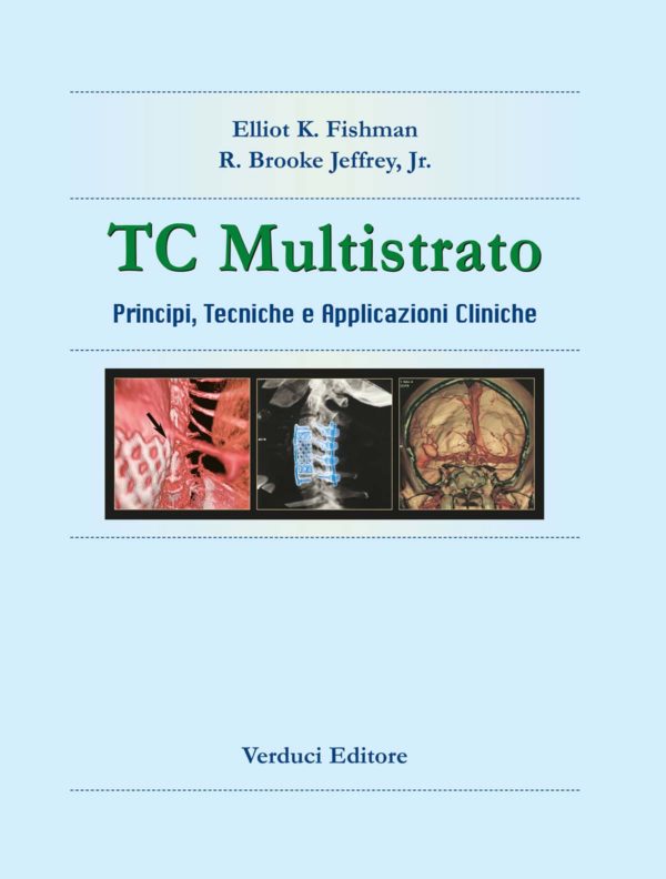 TC Multistrato