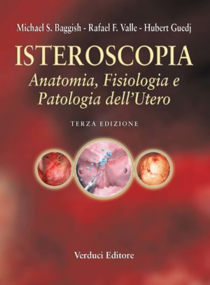 Isteroscopia