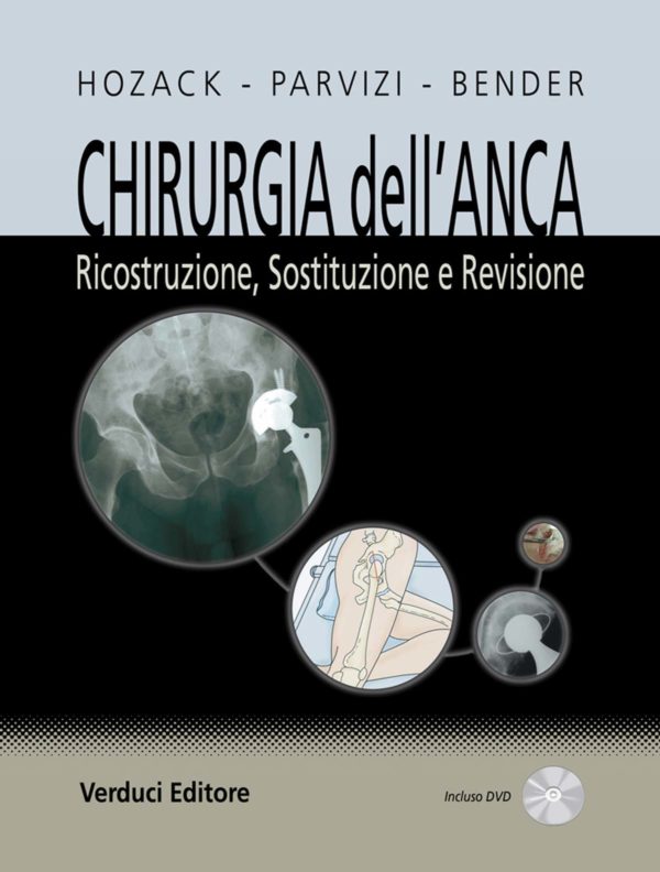 Chirurgia dell'Anca