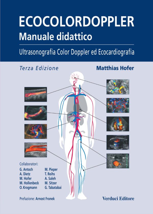 EcocolorDoppler