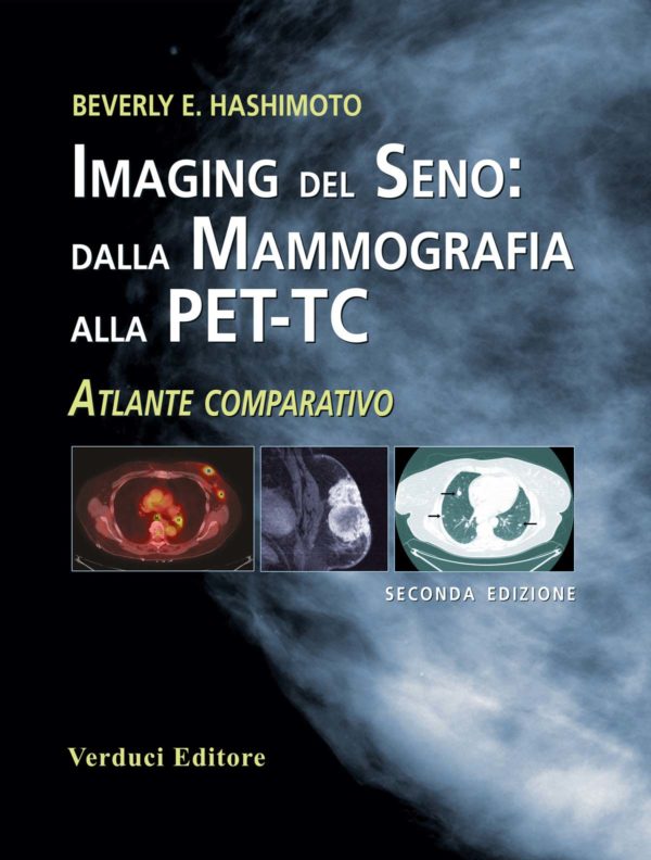 Imaging del Seno: dalla Mammografia alla PET-TC