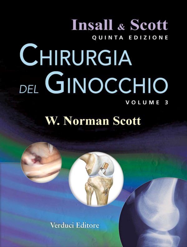 Chirurgia del Ginocchio