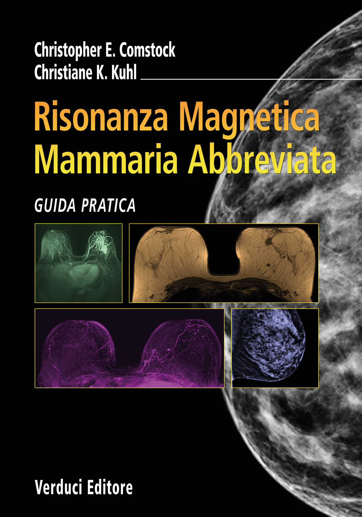 Cover of the book “Risonanza Magnetica Mammaria Abbreviata” featuring breast MRI images on a black background. Verduci Editore.