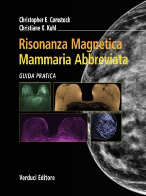 Risonanza Magnetica Mammaria Abbreviata