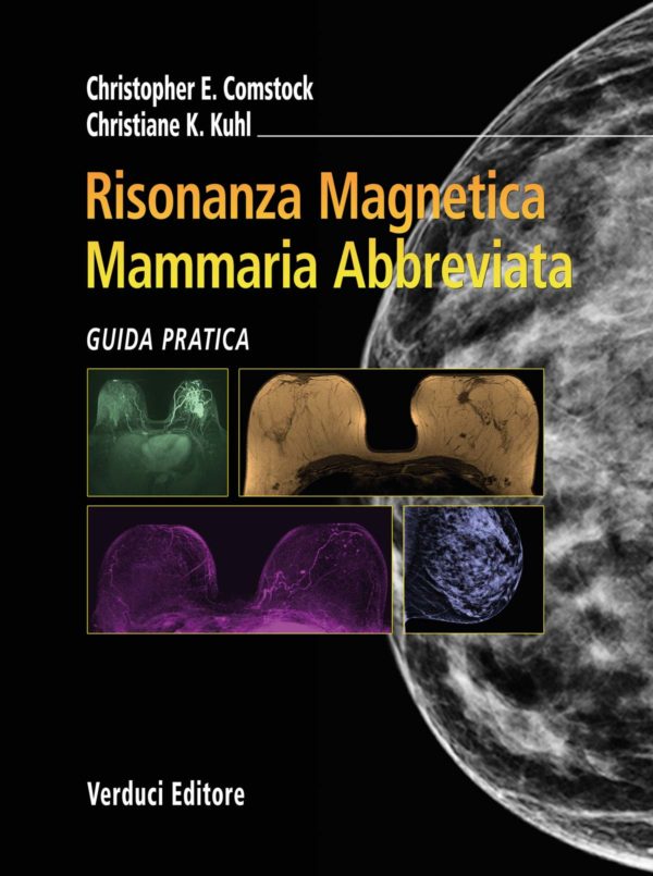 Risonanza Magnetica Mammaria Abbreviata