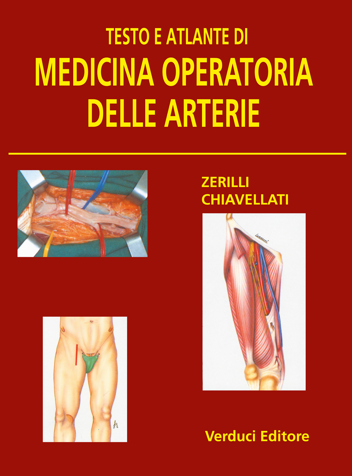Surgical illustration of the arteries