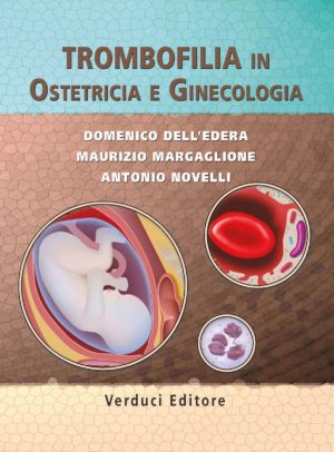 Trombofilia in Ostetricia e Ginecologia