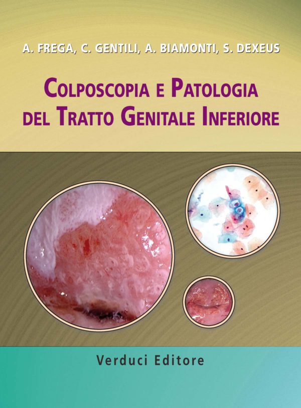 Colposcopia e Patologia del Tratto Genitale Inferiore