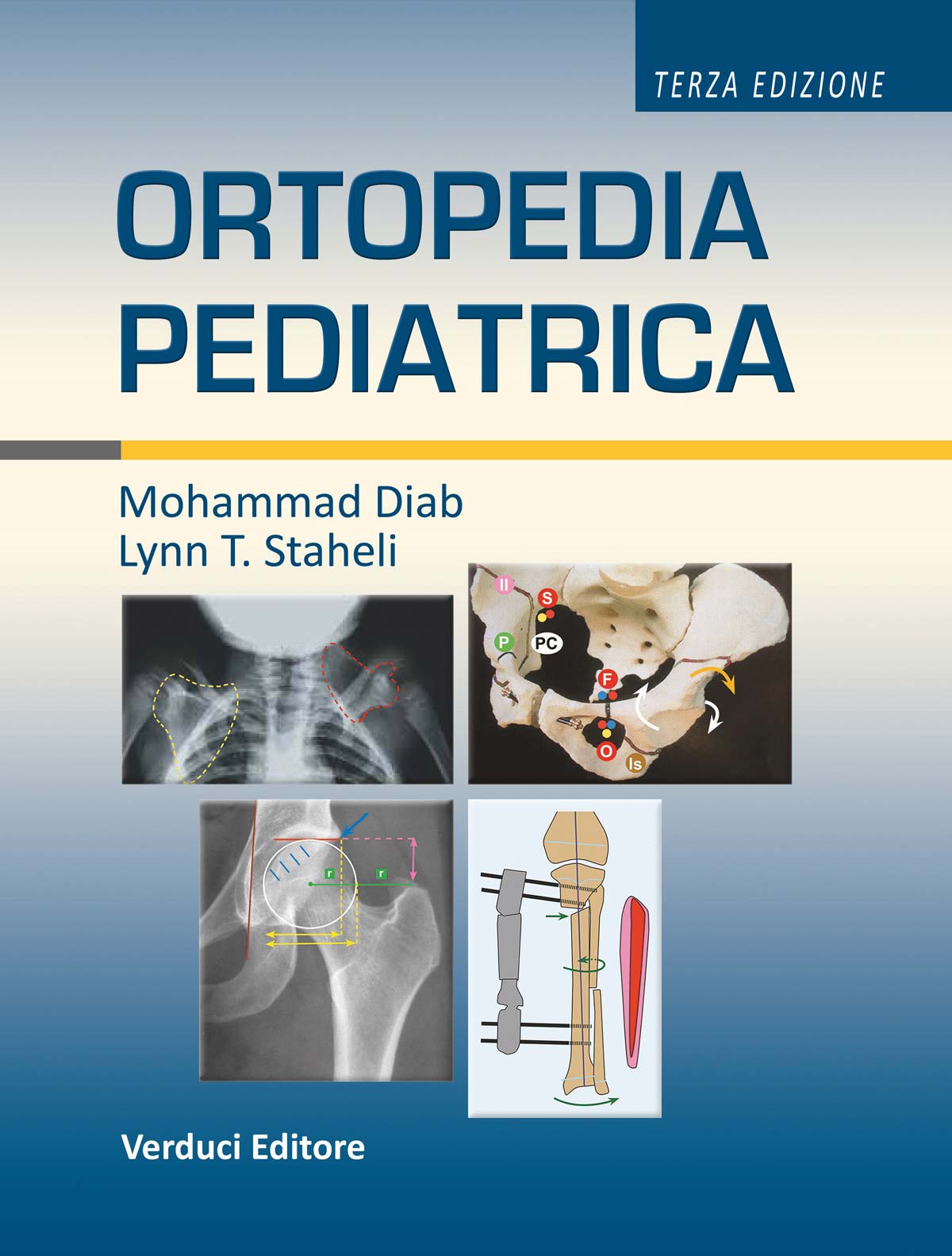 Cover of the book “Ortopedia Pediatrica”, third edition, by Mohammad Diab and Lynn T. Staheli. The cover shows the title on a gradient background and four illustrative images: a paediatric chest radiograph, a pelvic anatomy diagram, a hip radiograph with measurements, and an orthopaedic diagram of the lower limb. Verduci Editore logo at the bottom.