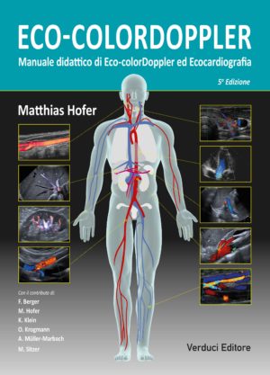 Eco-Colordoppler